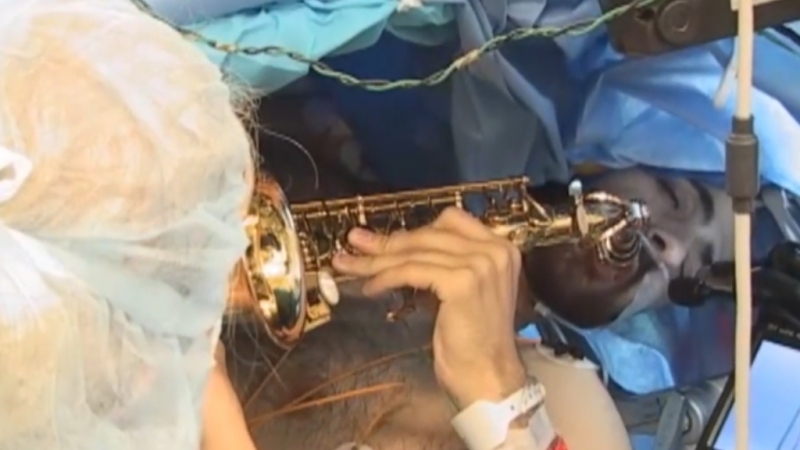 Игра на саксофоне во время операции на мозг.