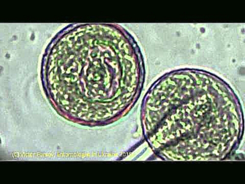 Под Микроскопом Цветочная Пыльца: Сирень, Жасмин, Тюльпан, Желтая Акация, Одуванчик. 